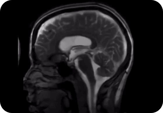 Nosies kvėpavimo menas - STRIPZ