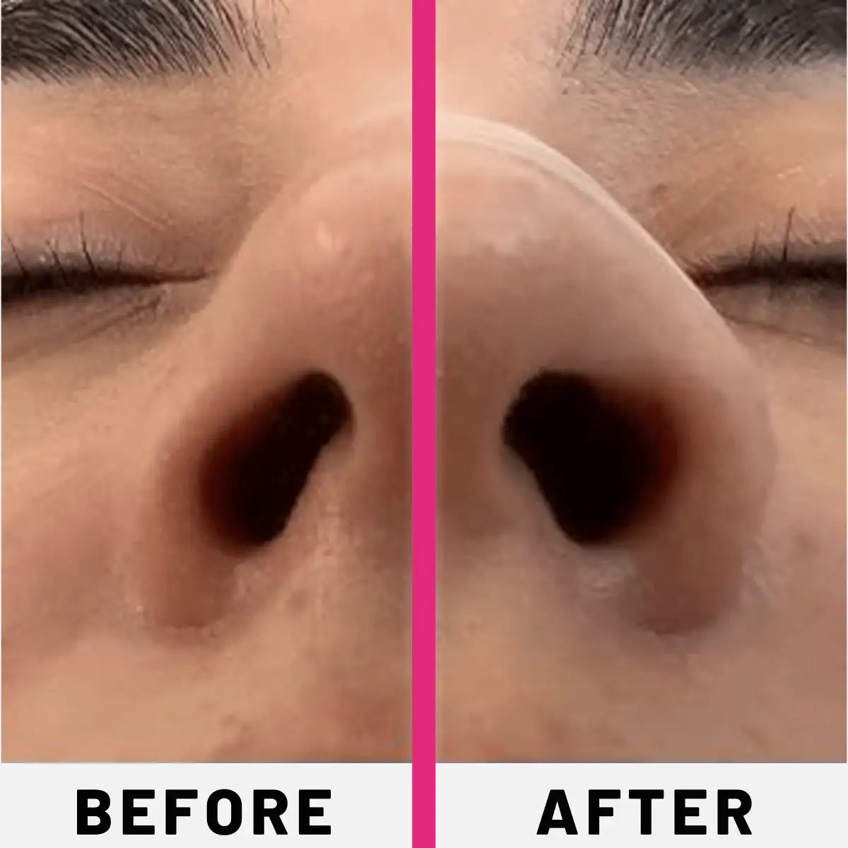 STRIPZ™ Oxygen Boost Nasal Strips | BUY 1 - GET 1 FREE